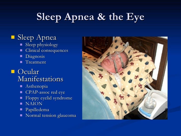 sleep apnea and the