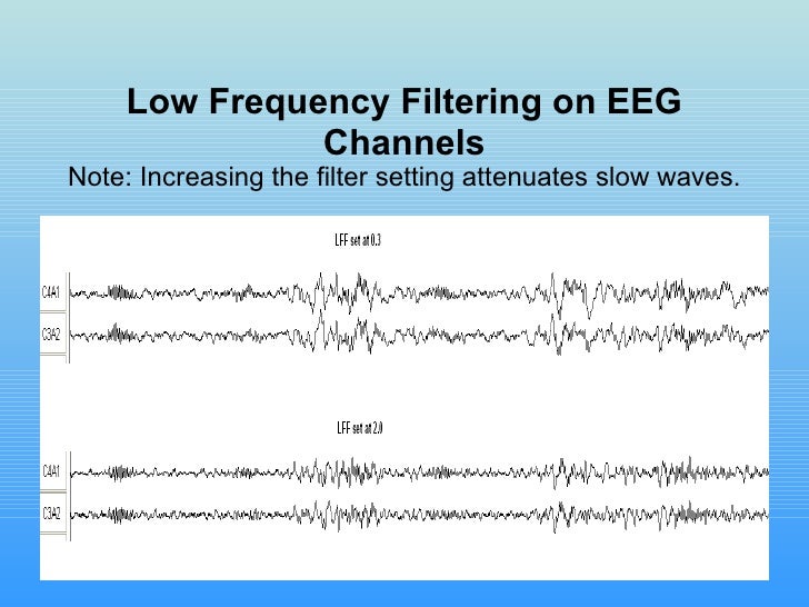 Sleep 2008 Electronicsv.3