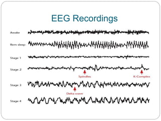 EEG Recordings
 