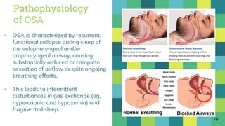 Pathophysiology
of OSA
▪ OSA is characterized by recurrent,
functional collapse during sleep of
the velopharyngeal and/or
oropharyngeal airway, causing
substantially reduced or complete
cessation of airflow despite ongoing
breathing efforts.
▪ This leads to intermittent
disturbances in gas exchange (eg,
hypercapnia and hypoxemia) and
fragmented sleep.
10
 