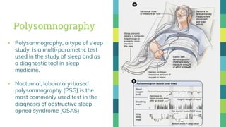 Polysomnography
▪ Polysomnography, a type of sleep
study, is a multi-parametric test
used in the study of sleep and as
a diagnostic tool in sleep
medicine.
▪ Nocturnal, laboratory-based
polysomnography (PSG) is the
most commonly used test in the
diagnosis of obstructive sleep
apnea syndrome (OSAS)
19
 