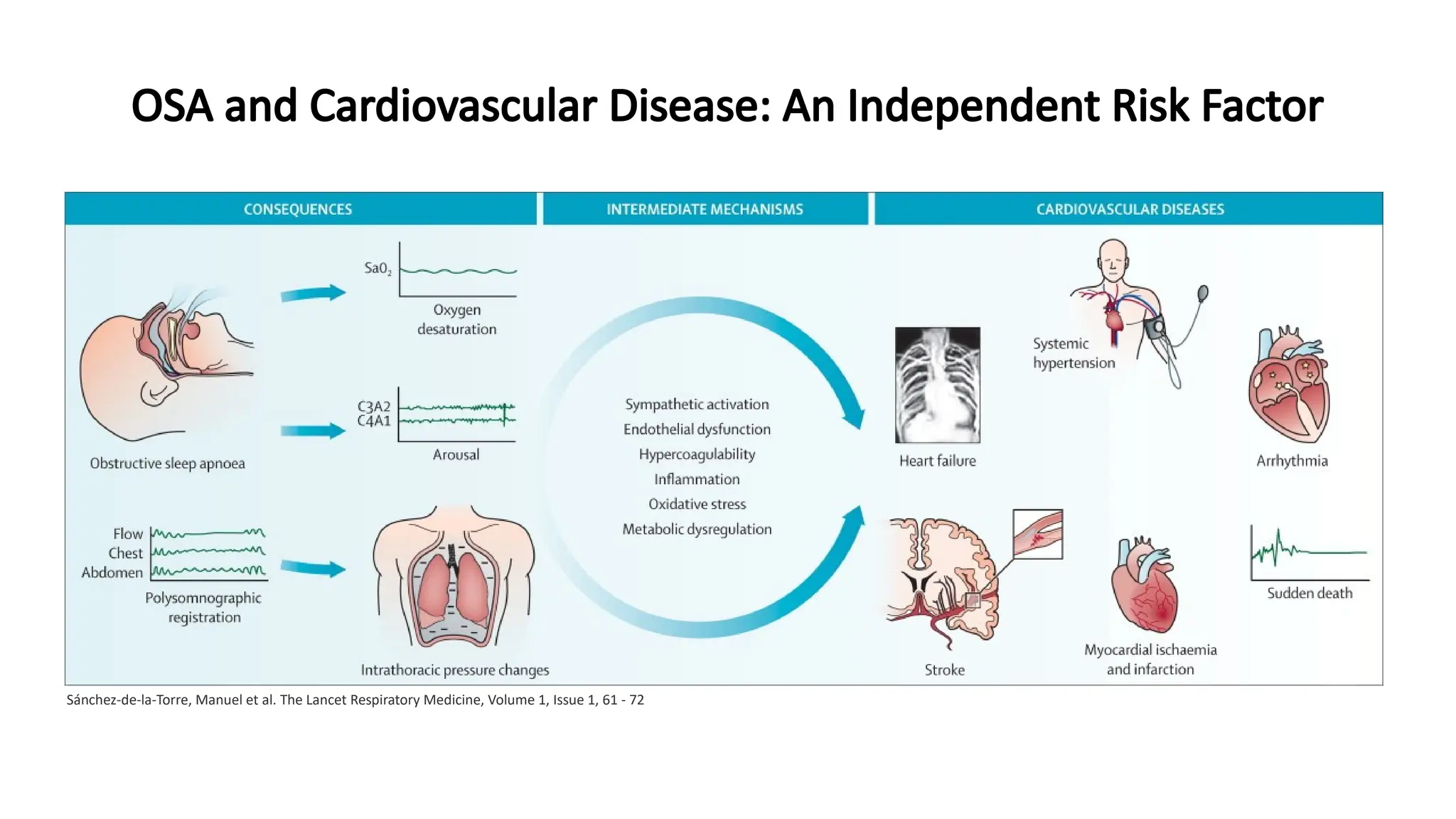 OSA and Cardiovascular Disease: An Independent Risk Factor
Sánchez-de-la-Torre, Manuel et al. The Lancet Respiratory Medicine, Volume 1, Issue 1, 61 - 72
 