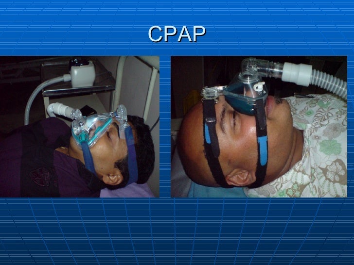 Sleep Apnea And Cosmetic Surgery Jubilee Hospital Trivandrum