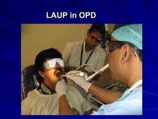 LAUP in OPD
 