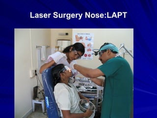 Laser Surgery Nose:LAPT
 