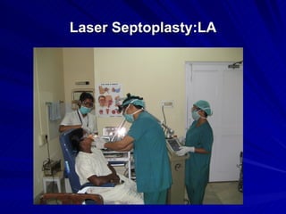 Laser Septoplasty:LA
 