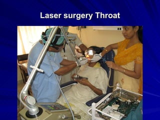 Laser surgery Throat
 