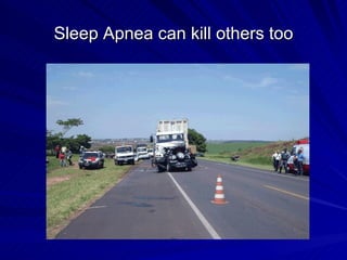 Sleep Apnea can kill others too
 