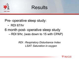 Sleep Study Rdi Meaning Introduction to Sleep apnea for Orthodontists | PPTX