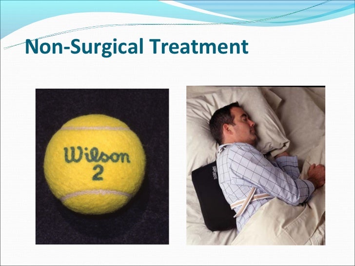 Sleep apnea & its treatment