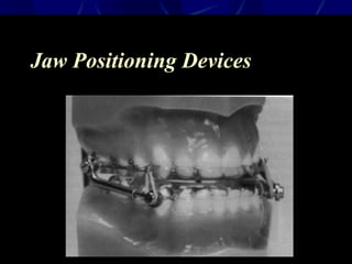 Jaw Positioning Devices
 