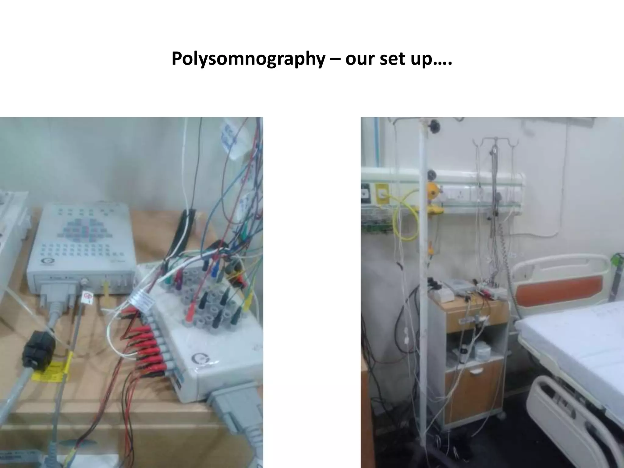 Polysomnography – our set up….
 