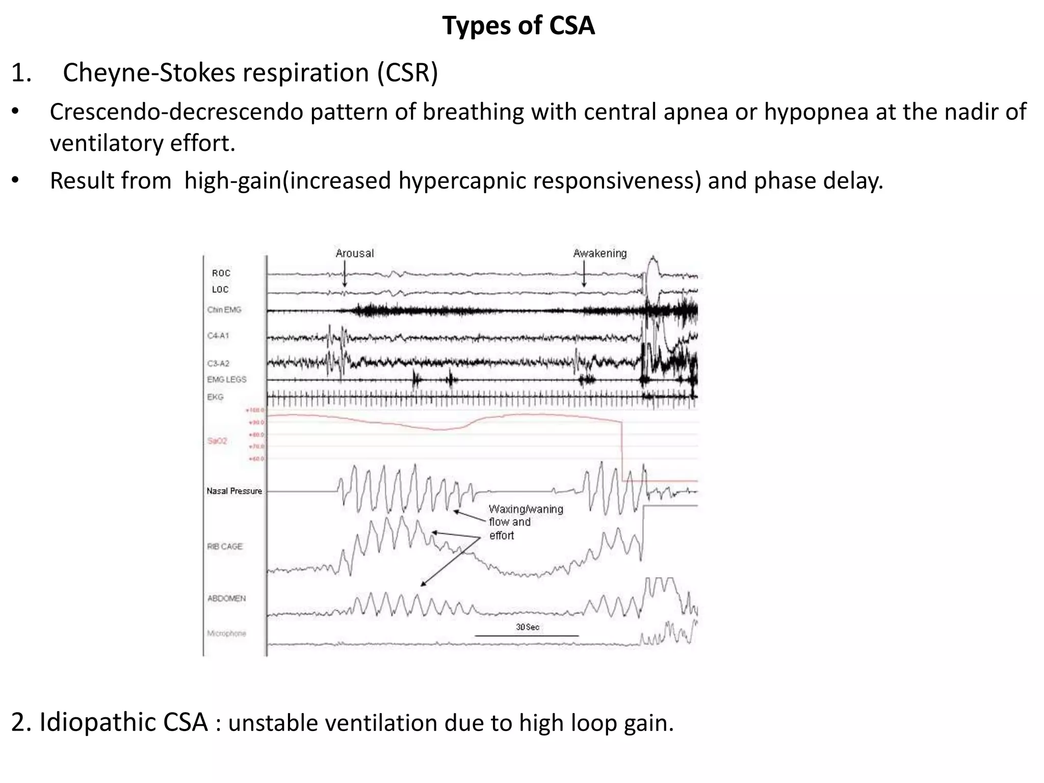 Types of CSA
1. Cheyne-Stokes respiration (CSR)
• Crescendo-decrescendo pattern of breathing with central apnea or hypopnea at the nadir of
ventilatory effort.
• Result from high-gain(increased hypercapnic responsiveness) and phase delay.
2. Idiopathic CSA : unstable ventilation due to high loop gain.
 