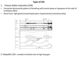 Types of CSA
1. Cheyne-Stokes respiration (CSR)
• Crescendo-decrescendo pattern of breathing with central apnea or hypopnea at the nadir of
ventilatory effort.
• Result from high-gain(increased hypercapnic responsiveness) and phase delay.
2. Idiopathic CSA : unstable ventilation due to high loop gain.
 