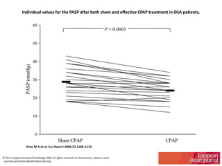 Individual values for the PASP after both sham and effective CPAP treatment in OSA patients.
Arias M A et al. Eur Heart J 2006;27:1106-1113
© The European Society of Cardiology 2006. All rights reserved. For Permissions, please e-mail:
journals.permissions@oxfordjournals.org
 