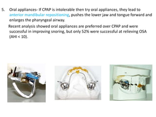 5. Oral appliances- If CPAP is intolerable then try oral appliances, they lead to
anterior mandibular repositioning, pushes the lower jaw and tongue forward and
enlarges the pharyngeal airway.
Recent analysis showed oral appliances are preferred over CPAP and were
successful in improving snoring, but only 52% were successful at relieving OSA
(AHI < 10).
 