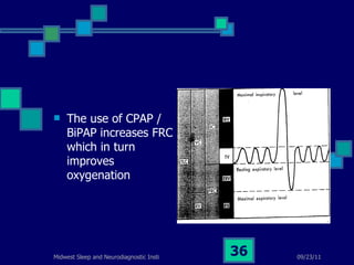 The use of CPAP / BiPAP increases FRC which in turn improves oxygenation 