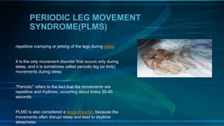 PERIODIC LEG MOVEMENT
SYNDROME(PLMS)
repetitive cramping or jerking of the legs during sleep.
It is the only movement disorder that occurs only during
sleep, and it is sometimes called periodic leg (or limb)
movements during sleep.
"Periodic" refers to the fact that the movements are
repetitive and rhythmic, occurring about every 20-40
seconds.
PLMD is also considered a sleep disorder, because the
movements often disrupt sleep and lead to daytime
sleepiness.
 