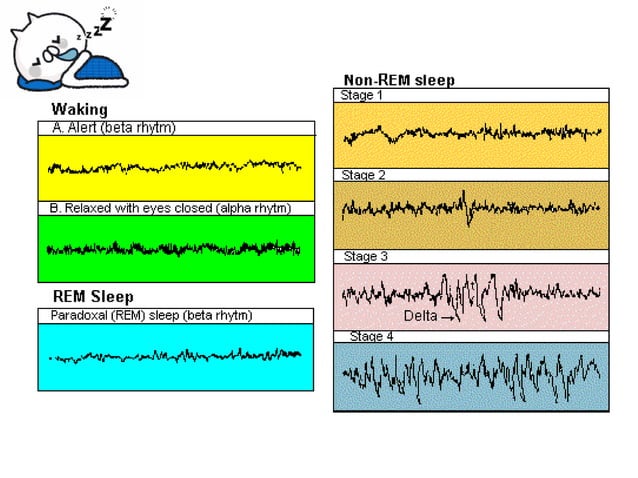 Physiology of Sleep | PDF | Sleep Disorders | Diseases and Conditions