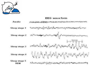Sleep Study Waveforms Physiology of Sleep | PDF