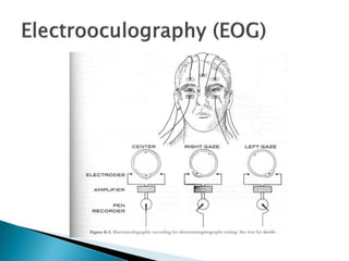  Electroencephalography (EEG)
26
Sleep Measurement
Tools
 