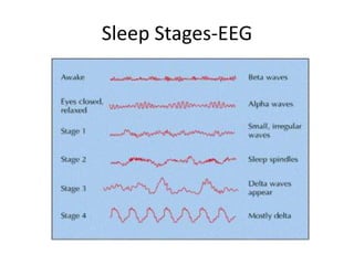 Sleep Stages-EEG
 