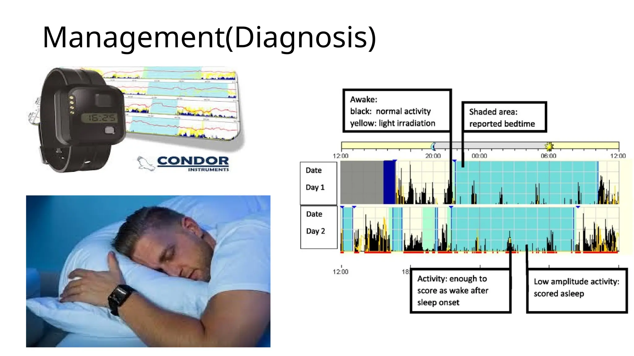 Image showcasing sleep disorders diagnosis ,patho physiology and management | PPT
