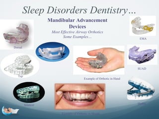 Suad Example Sleep disorders dentistry | PPT