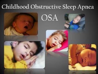 Childhood Obstructive Sleep Apnea

OSA

 