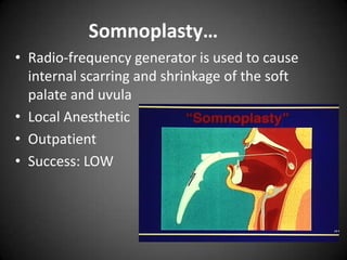 Somnoplasty…
• Radio-frequency generator is used to cause
internal scarring and shrinkage of the soft
palate and uvula
• Local Anesthetic
• Outpatient
• Success: LOW

 