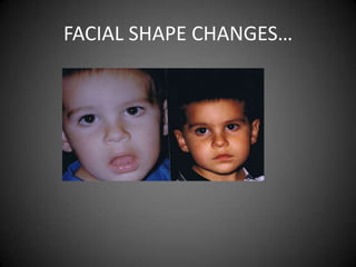FACIAL SHAPE CHANGES…

 