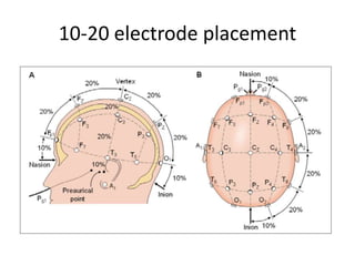 10-20 electrode placement
 