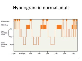 Hypnogram in normal adult
 