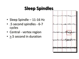 Sleep Spindles
• Sleep Spindle – 11-16 Hz
• .5 second spindles - 6-7
cycles
• Central - vertex region
• >.5 second in duration
 