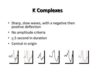 K Complexes
• Sharp, slow waves, with a negative then
positive deflection
• No amplitude criteria
• >.5 second in duration
• Central in origin
 