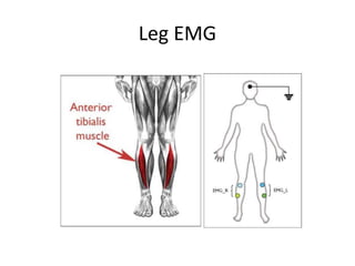 Leg EMG
 