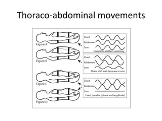 Thoraco-abdominal movements
 