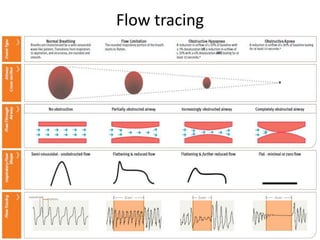 Flow tracing
 