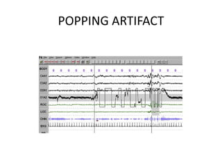 POPPING ARTIFACT
 