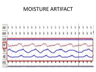 MOISTURE ARTIFACT
 