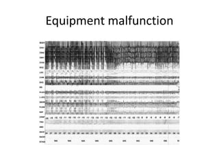 Equipment malfunction
 