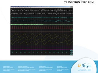TRANSITION INTO REM
 