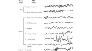 SLEEP EEG and findings, stages of sleep. | PPTX