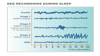 SLEEP EEG and findings, stages of sleep. | PPTX