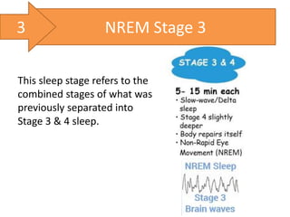 This sleep stage refers to the
combined stages of what was
previously separated into
Stage 3 & 4 sleep.
NREM Stage 33
 