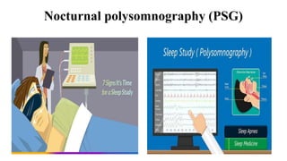 Nocturnal polysomnography (PSG)
 
