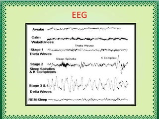 EEG
 