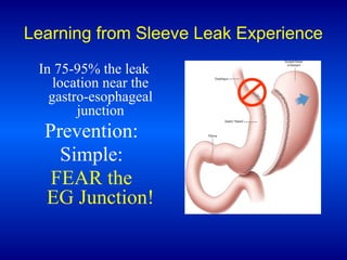 Learning from Sleeve Leak Experience
In 75-95% the leak
location near the
gastro-esophageal
junction

Prevention:
Simple:
FEAR the
EG Junction!

 