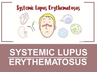 SYSTEMIC LUPUS
ERYTHEMATOSUS
 