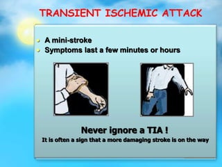 TRANSIENT ISCHEMIC ATTACK
 A mini-stroke
 Symptoms last a few minutes or hours
Never ignore a TIA !
It is often a sign that a more damaging stroke is on the way
 